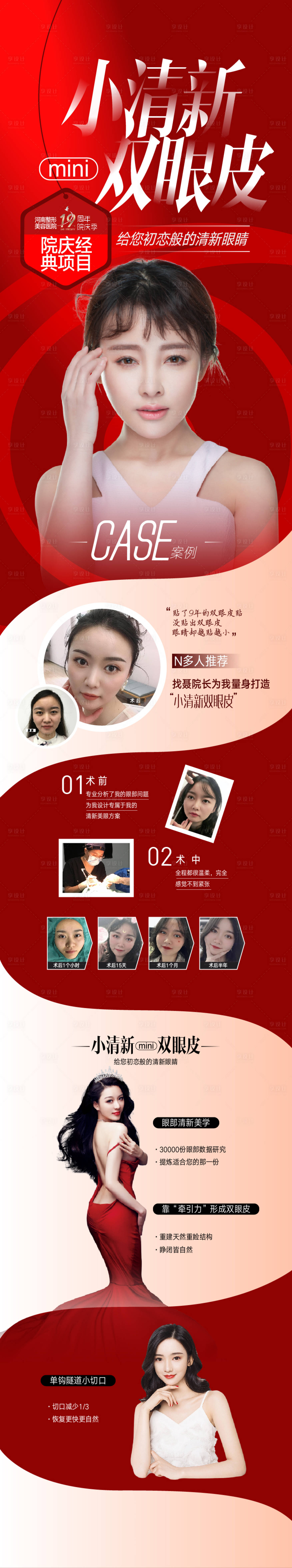 源文件下載【享設計】搜索編號：52180015894308004【小清新雙眼皮整形修復長圖】
