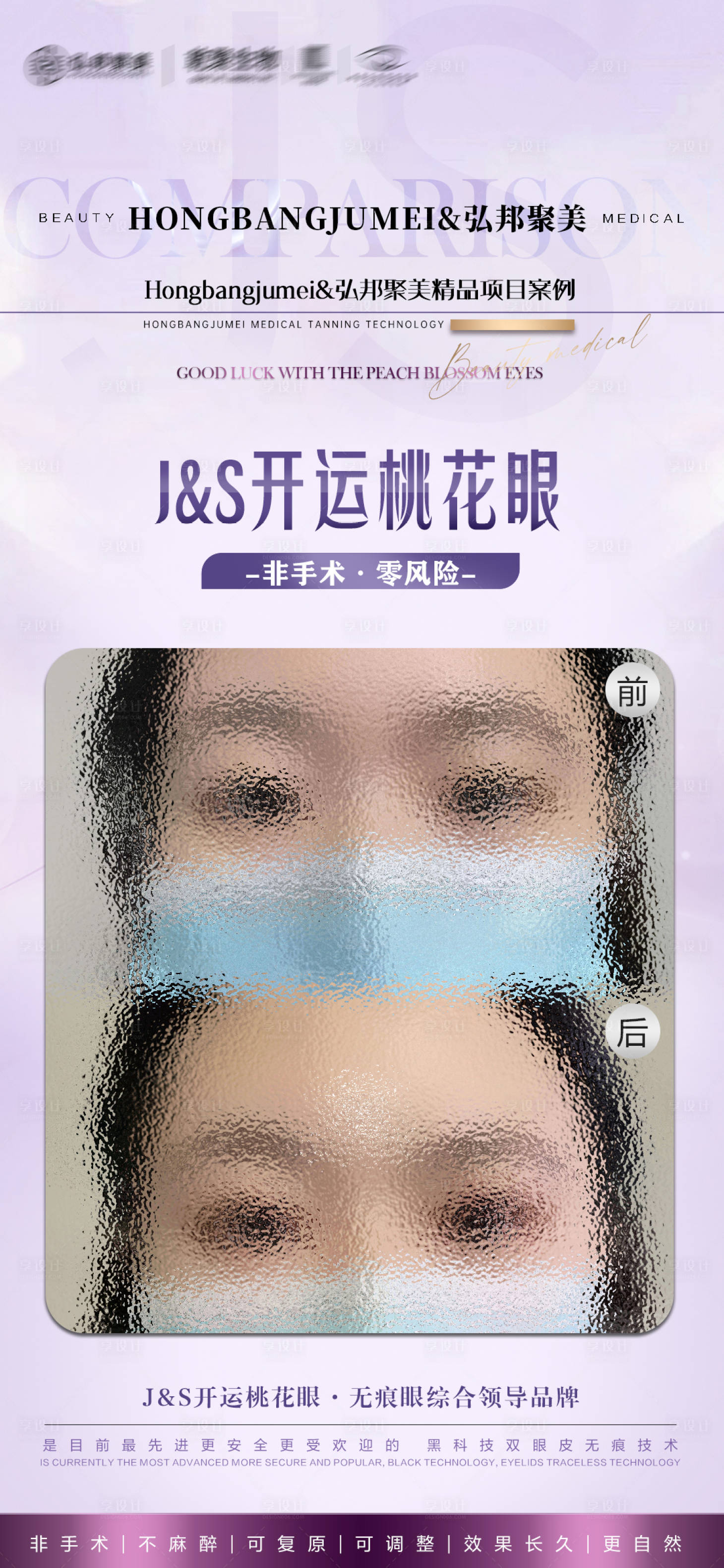 源文件下載【享設(shè)計】搜索編號：12860015991285774【醫(yī)美雙眼皮案例對比海報】