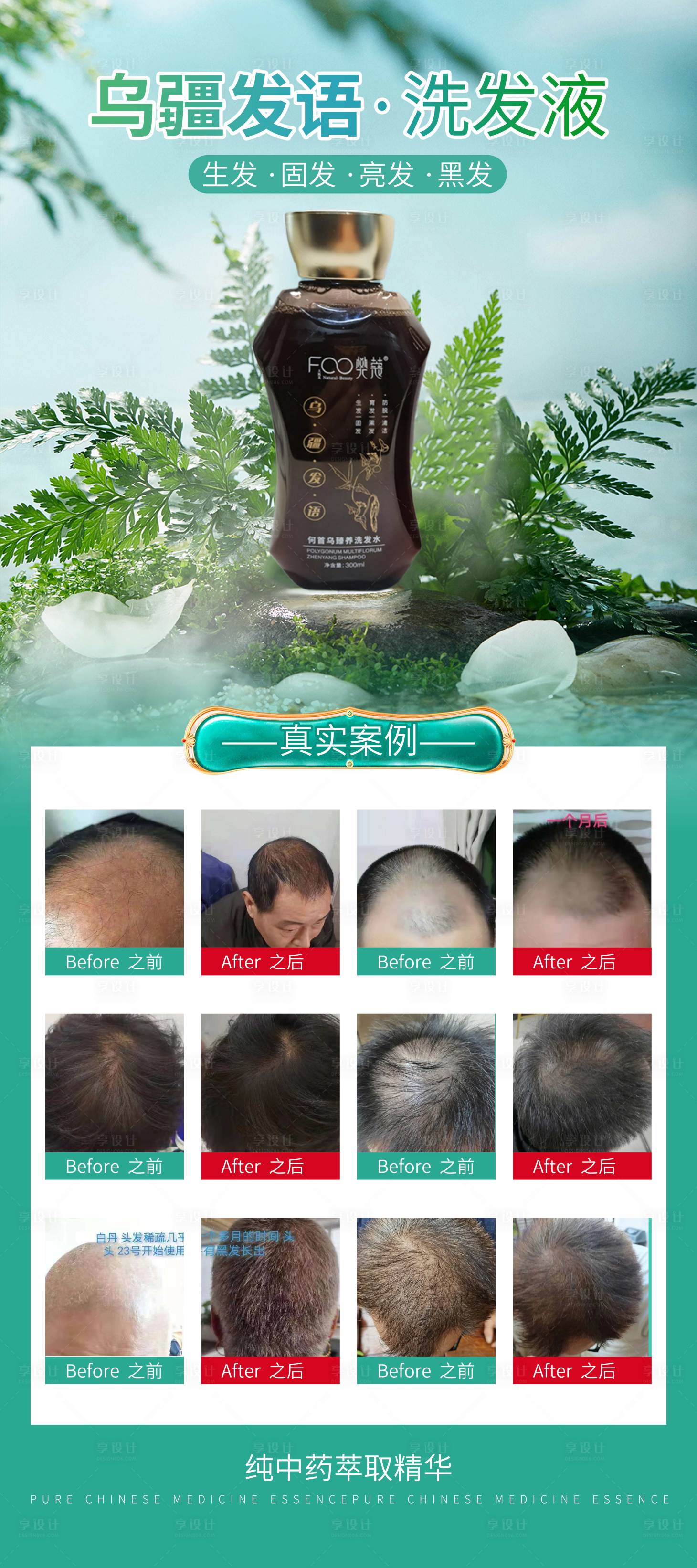 源文件下载【享设计】搜索编号：81820016161842100【生发液案例海报】