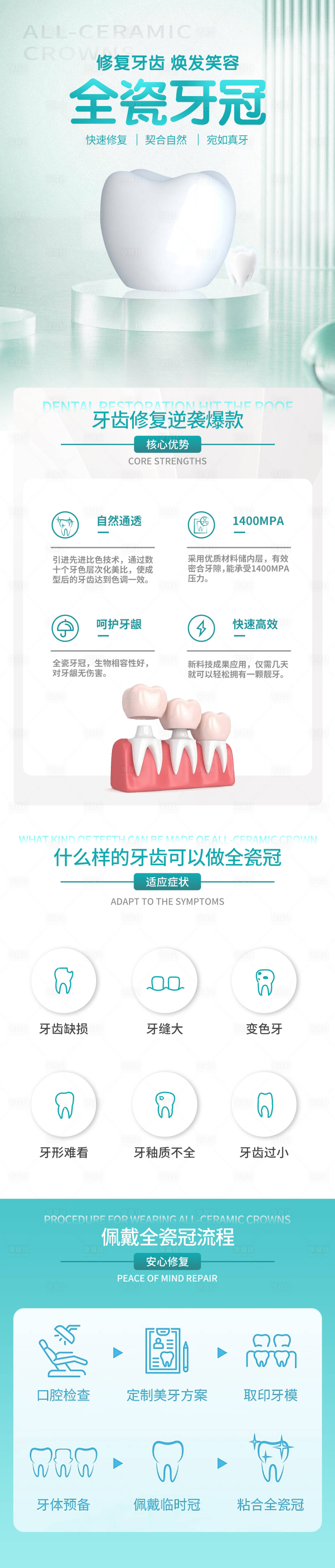 源文件下载【享设计】搜索编号：15250016398272195【全瓷牙冠详情页】