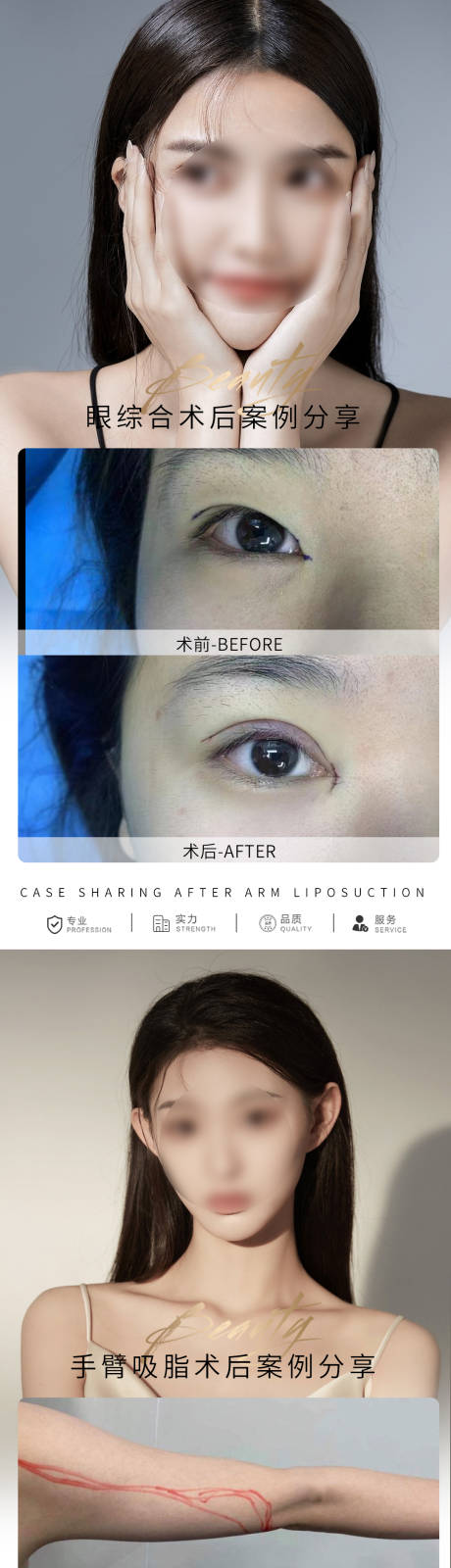 源文件下载【享设计】搜索编号：89650016067261507【医美案例对比系列海报】