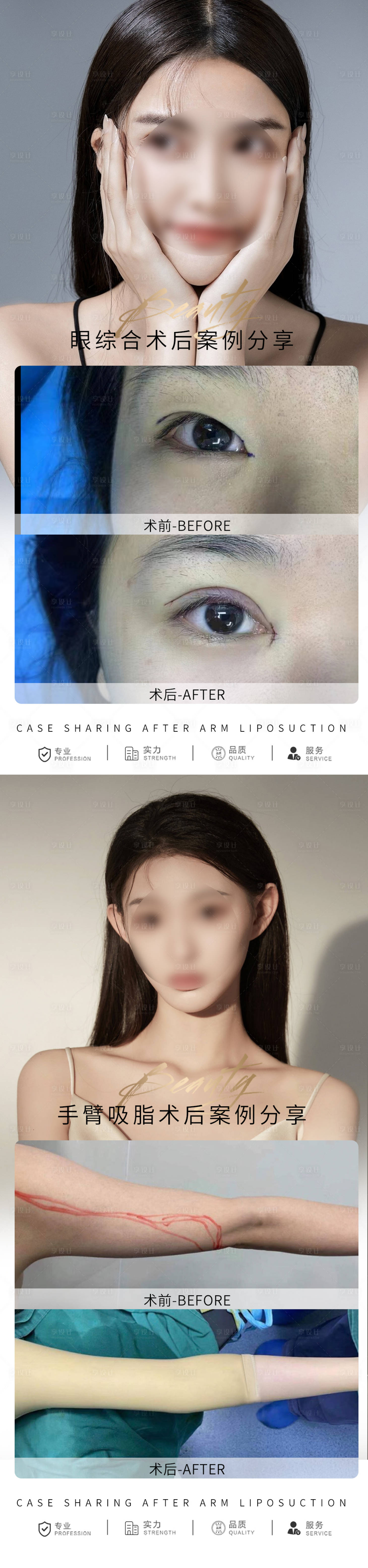 源文件下载【享设计】搜索编号：89650016067261507【医美案例对比系列海报】