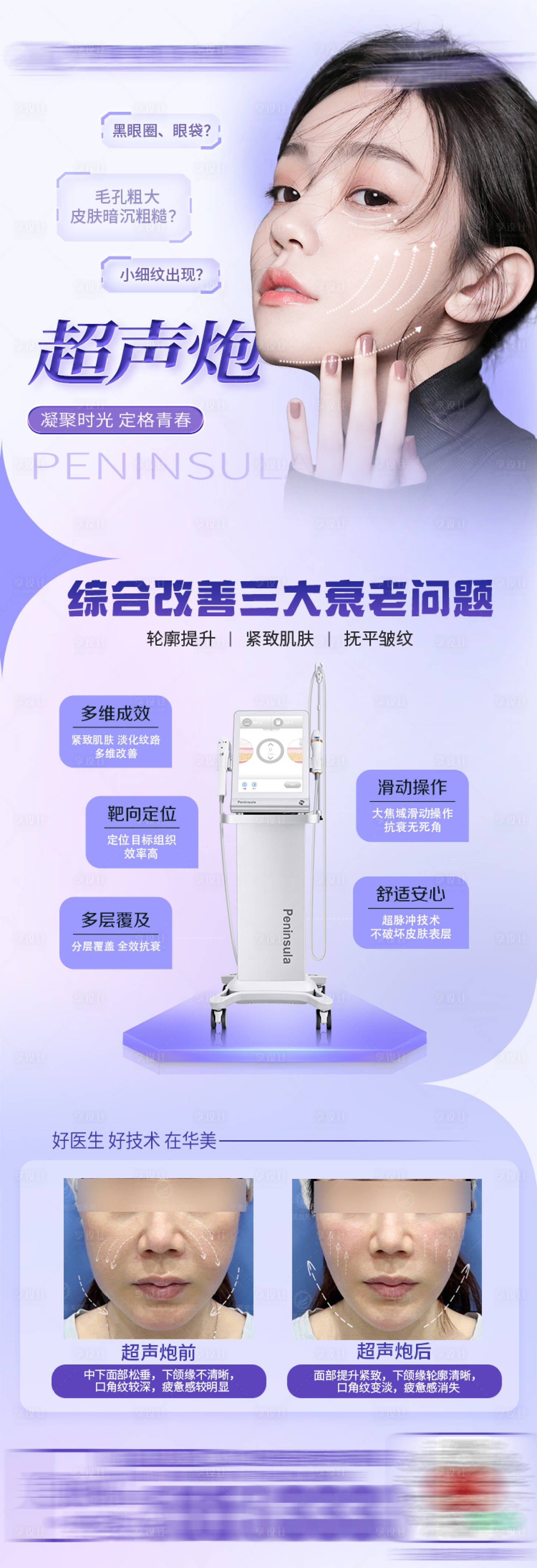 源文件下載【享設計】搜索編號：34550015953849162【抗衰儀器超聲炮長圖】