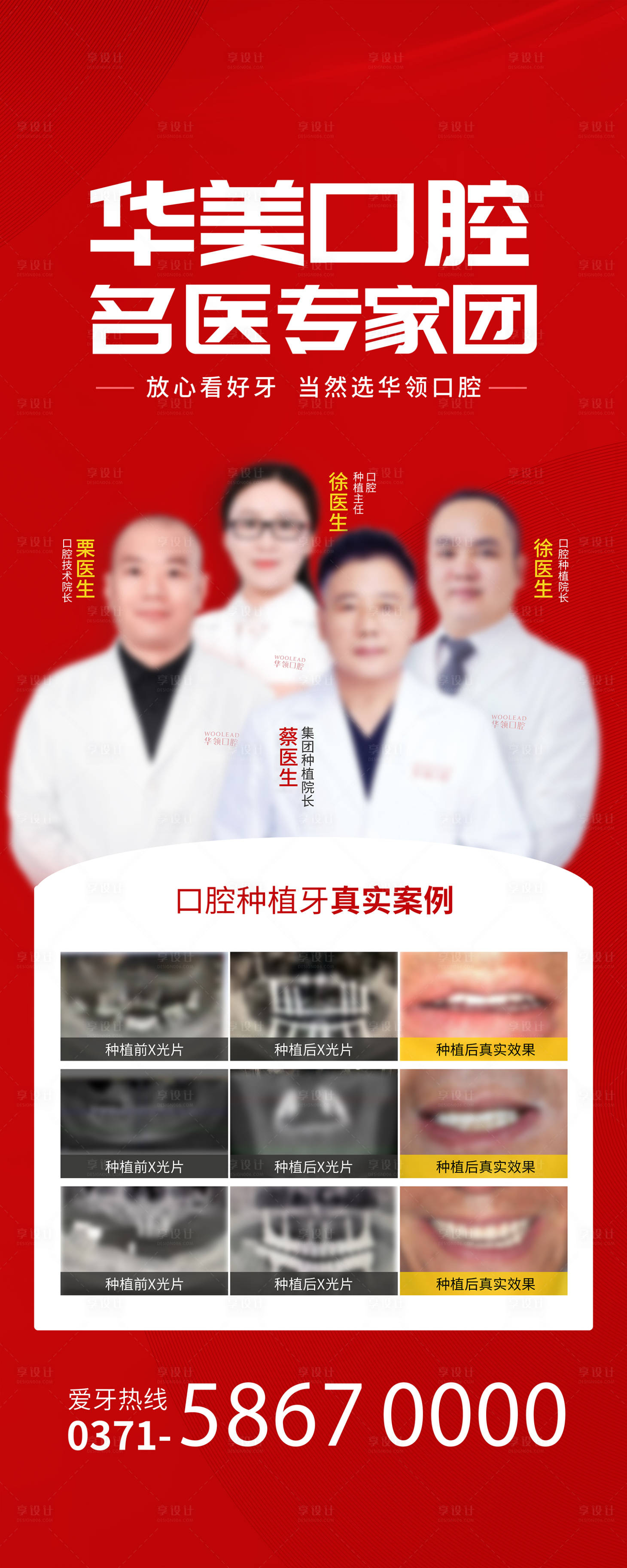 源文件下載【享設計】搜索編號：50390015817771006【醫美義診宣傳專家易拉寶】