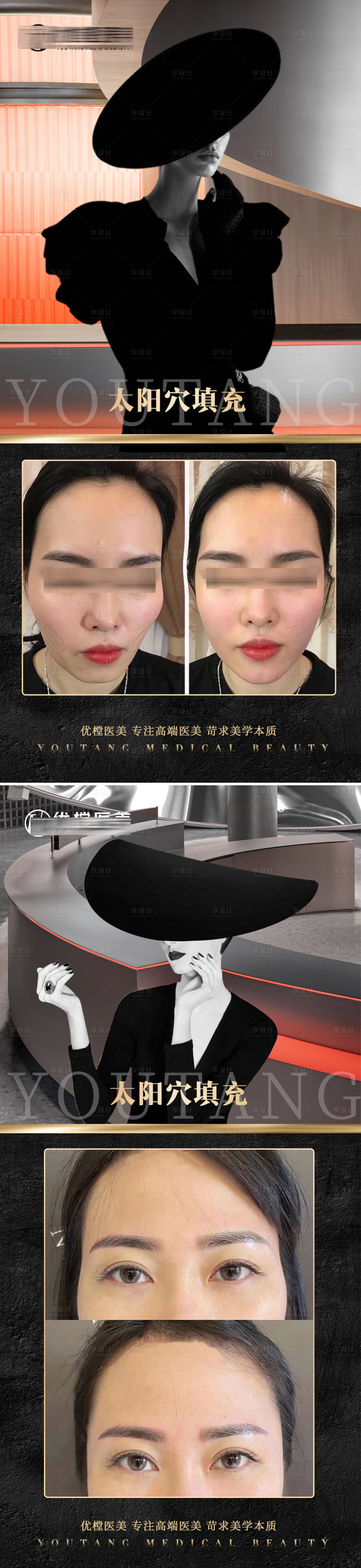源文件下載【享設(shè)計】搜索編號：64820015818459893【醫(yī)美案例海報】