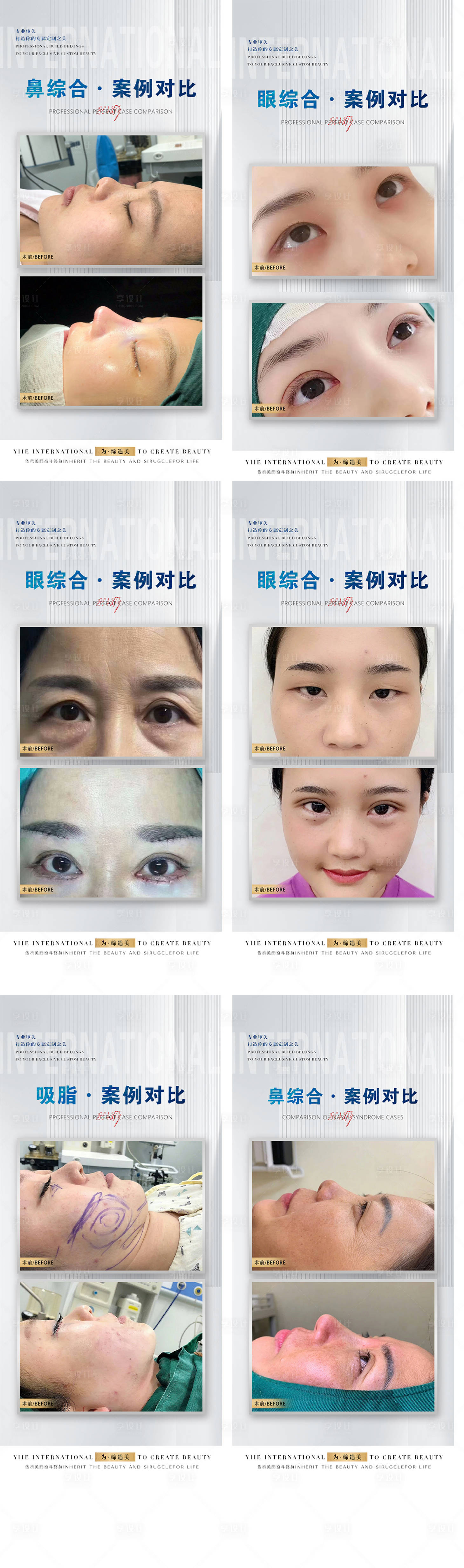 源文件下載【享設計】搜索編號：56780015869134811【醫美整外案例合集系列海報】