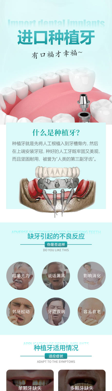 源文件下载【进口种植牙详情页】编号：20230430092153456