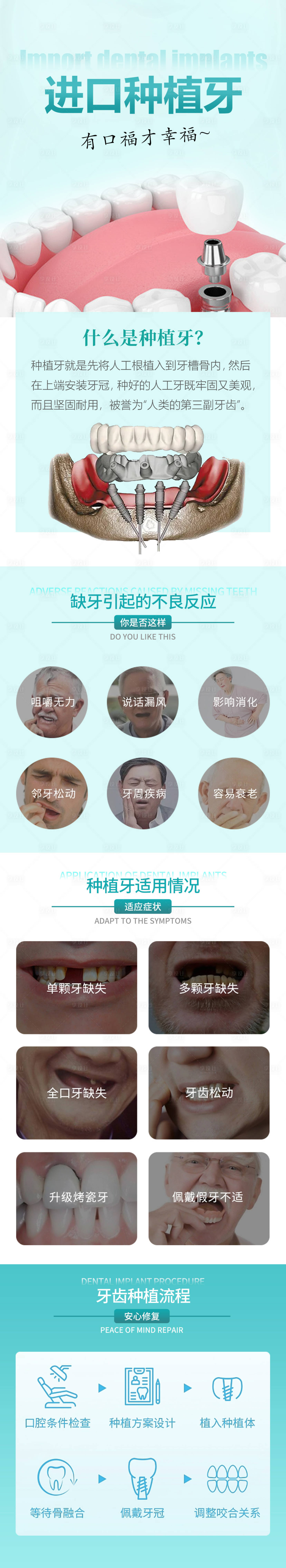 源文件下載【享設計】搜索編號：75790016398238404【進口種植牙詳情頁】