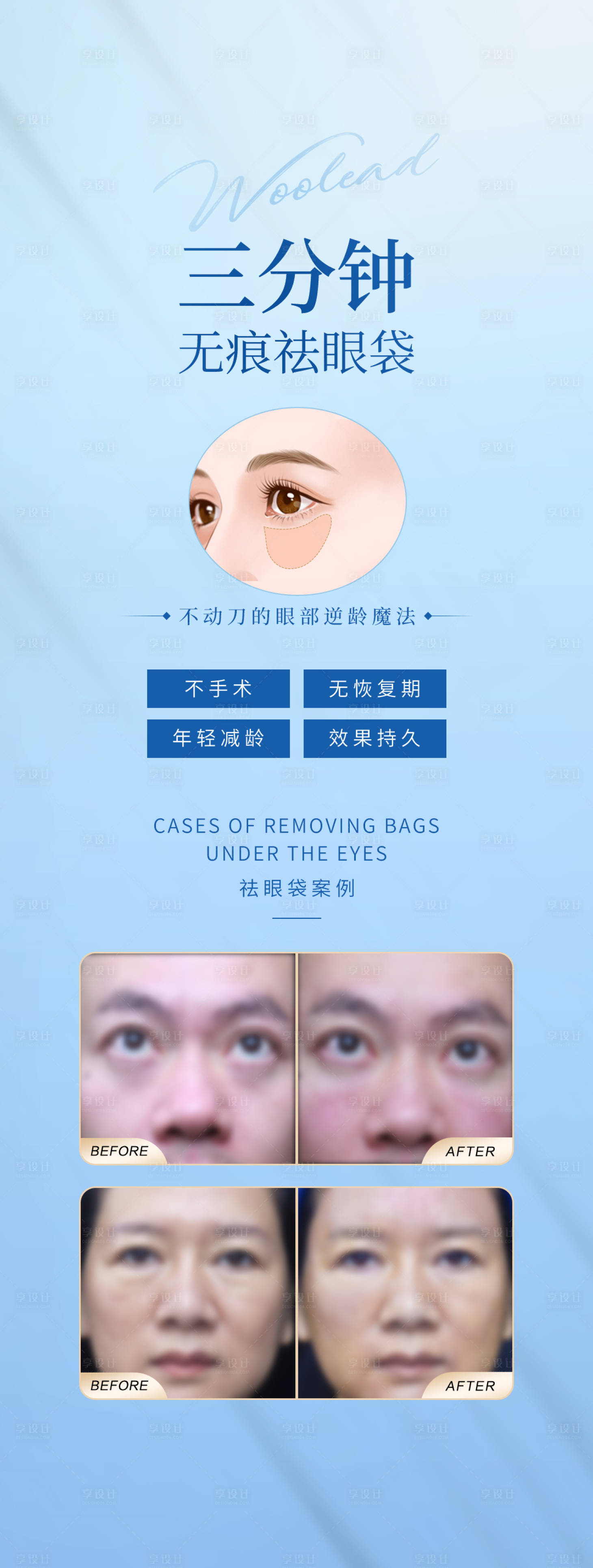 源文件下载【享设计】搜索编号：24870015794903276【医美三分钟祛眼袋海报】