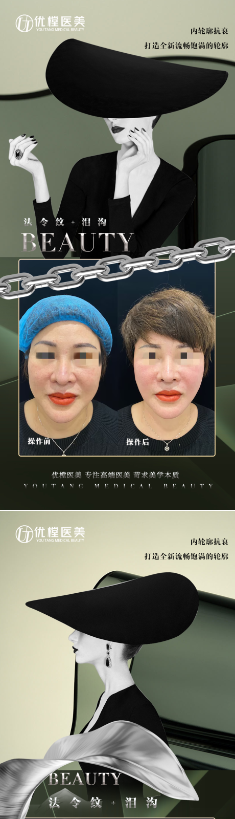 源文件下载【医美案例海报】编号：48260015809549860