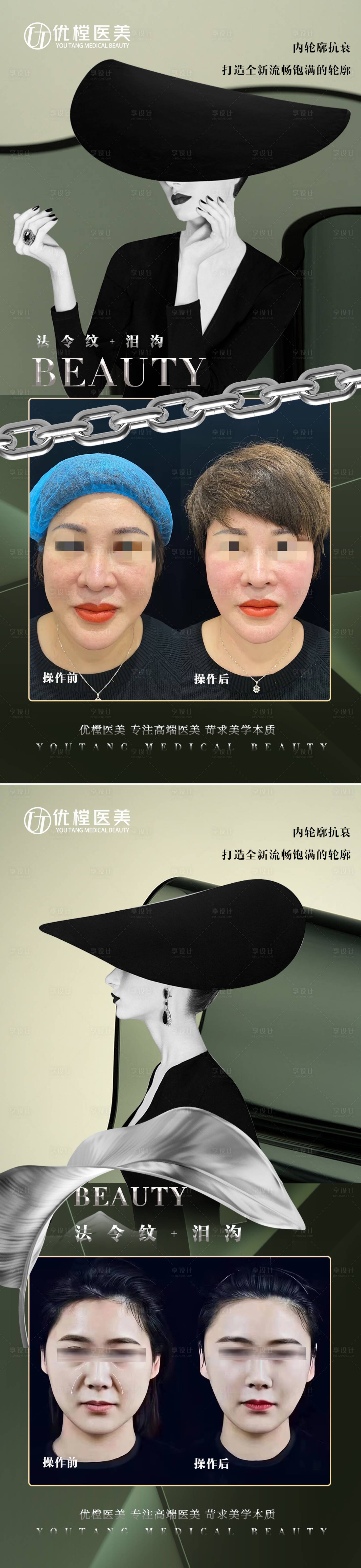 源文件下载【医美案例海报】编号：48260015809549860