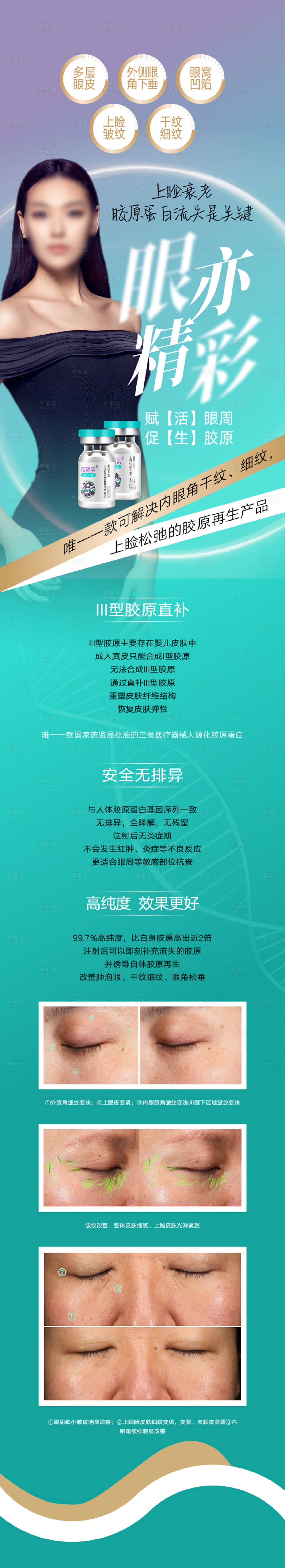 源文件下載【享設計】搜索編號：60810016112885045【眼部年輕化除皺整形廣告設計】