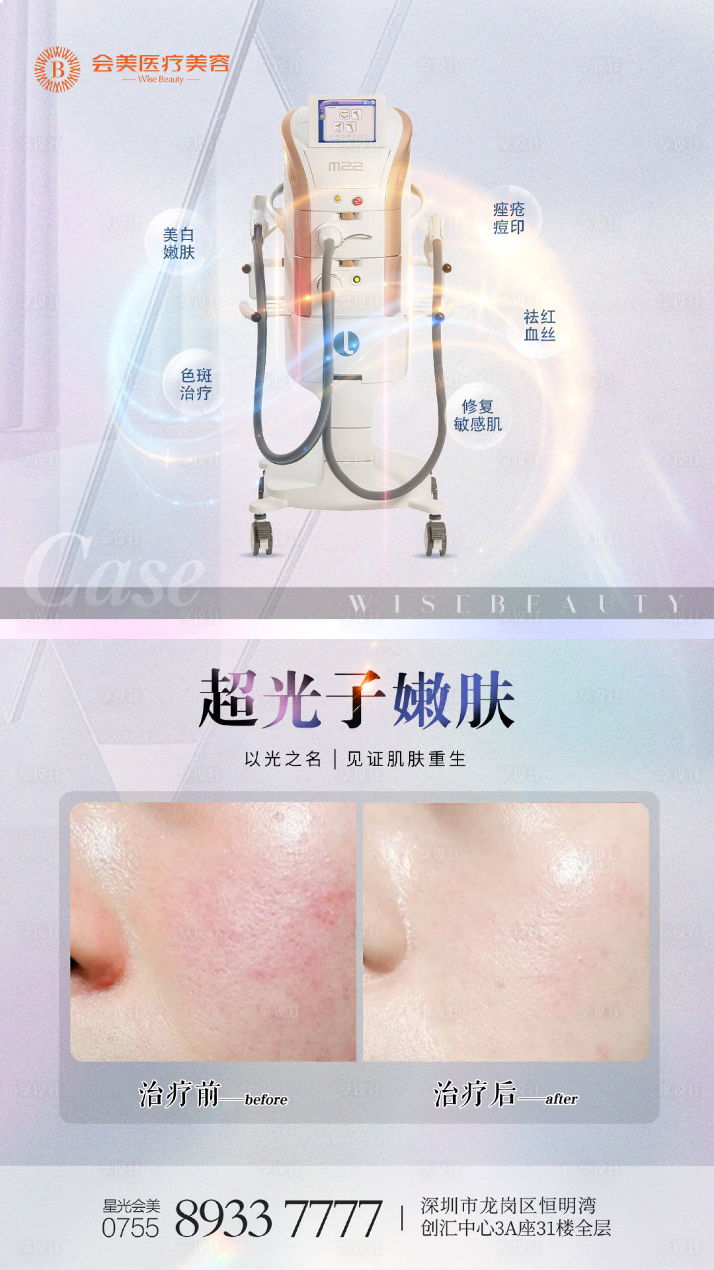 源文件下载【享设计】搜索编号：63010016112013126【黄金超光子案例海报】