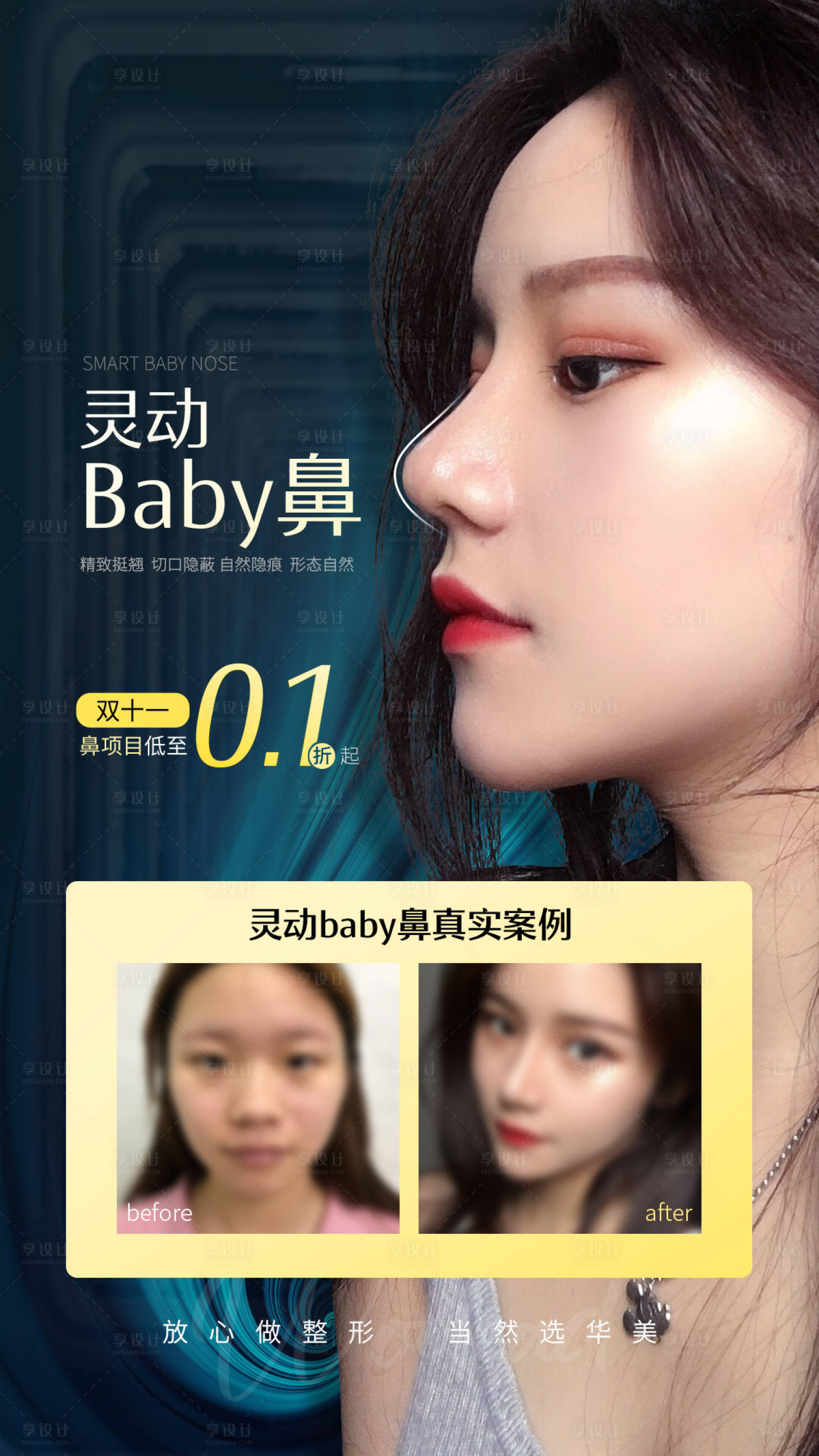 源文件下載【享設計】搜索編號：92870015845079013【醫美鼻部整形案例海報】