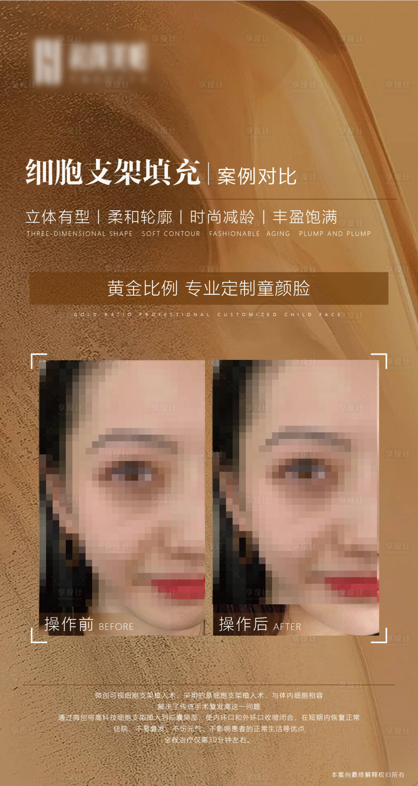 源文件下載【享設計】搜索編號：97300015687786594【醫(yī)美對比圖排版簡約海報】