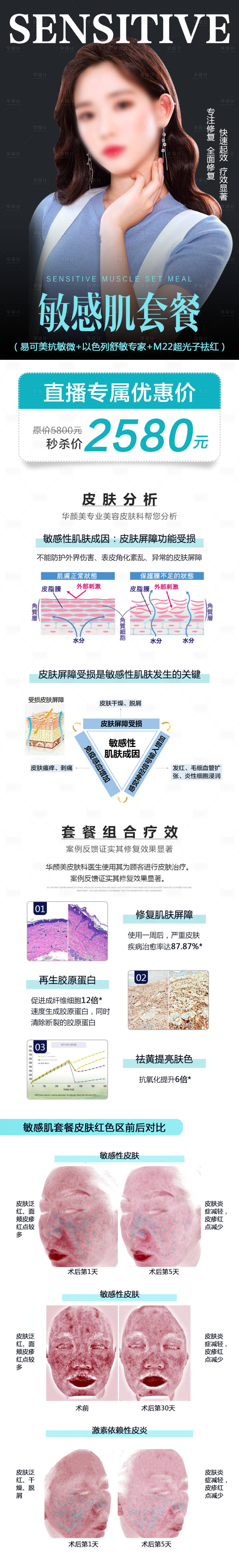源文件下载【享设计】搜索编号：68890015751915460【敏感肌套餐易可美抗敏详情】