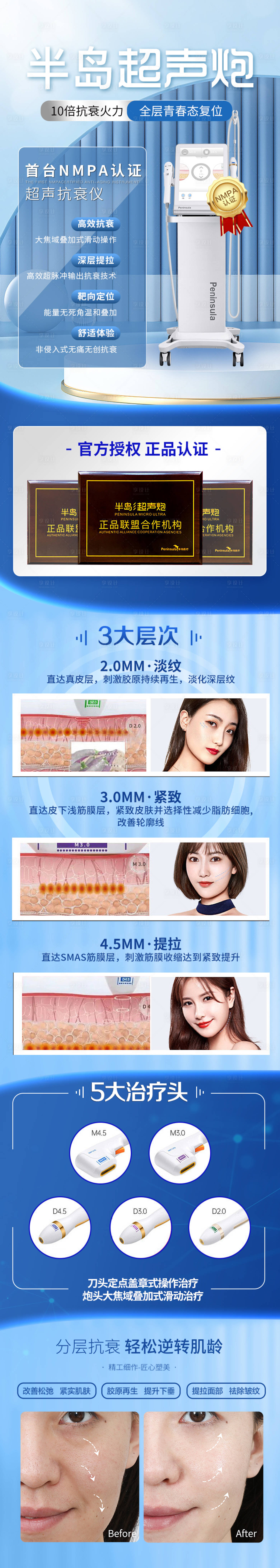 源文件下載【享設(shè)計】搜索編號：91530015983305851【超聲炮長圖】