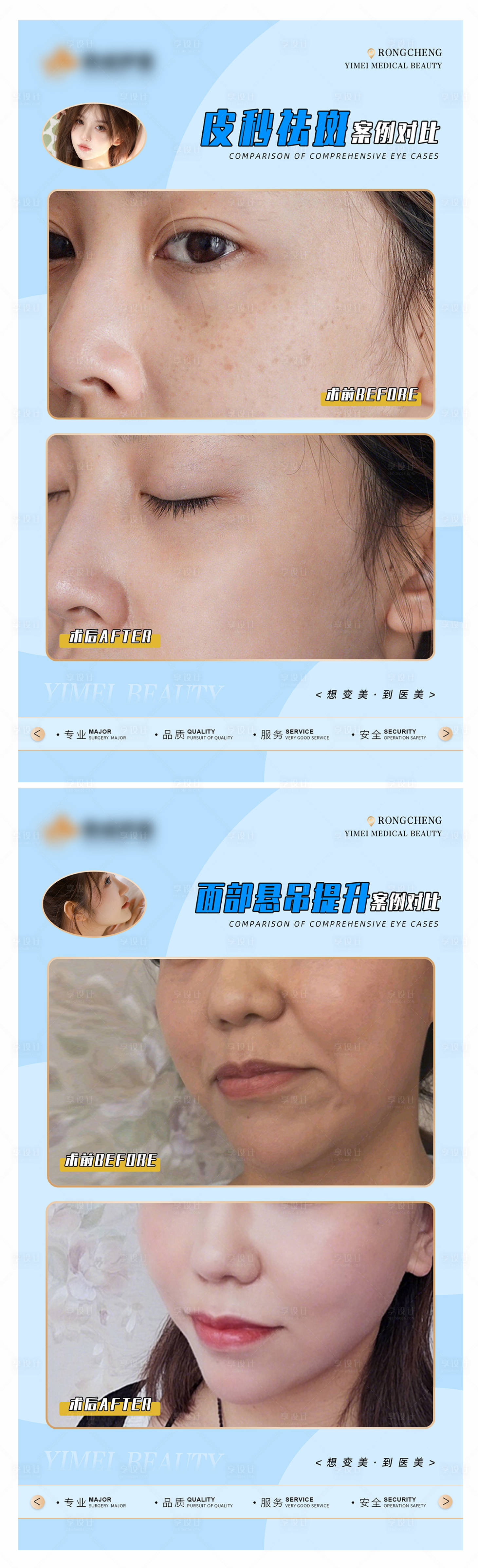 源文件下載【享設計】搜索編號：13380016269908241【醫美案例模板】