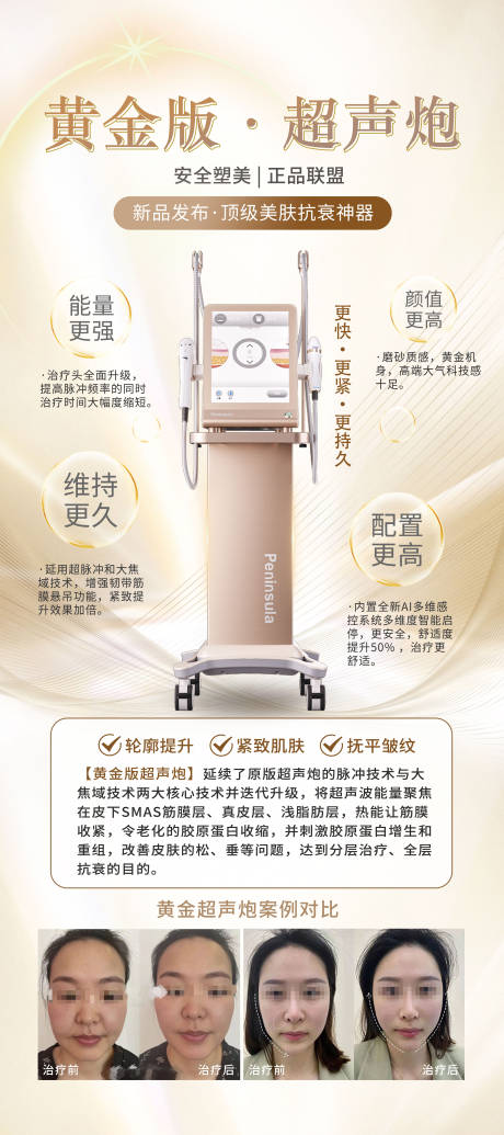 源文件下载【黄金版超声炮介绍】编号：91140015795492630