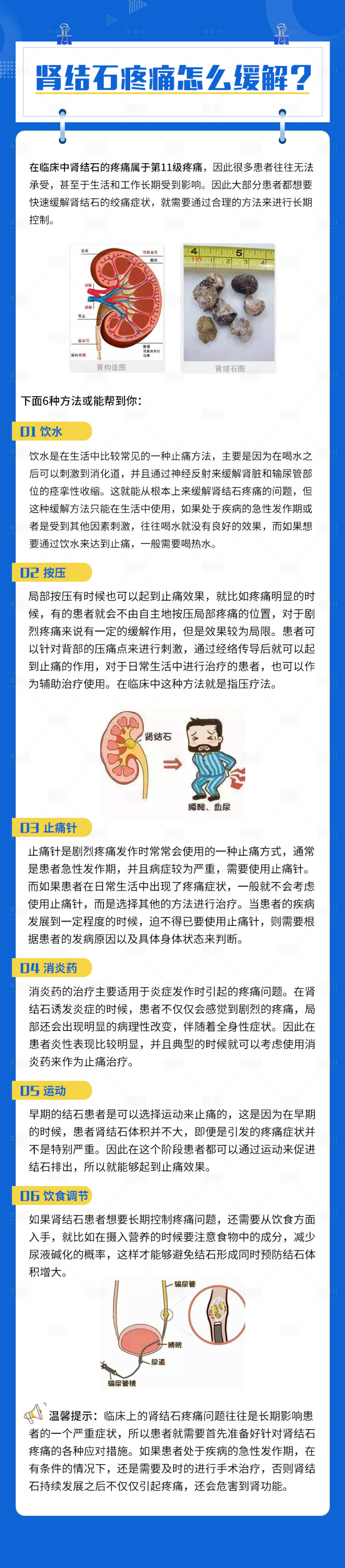 源文件下载【享设计】搜索编号：14390015884272040【肾结石朋友圈科普海报】