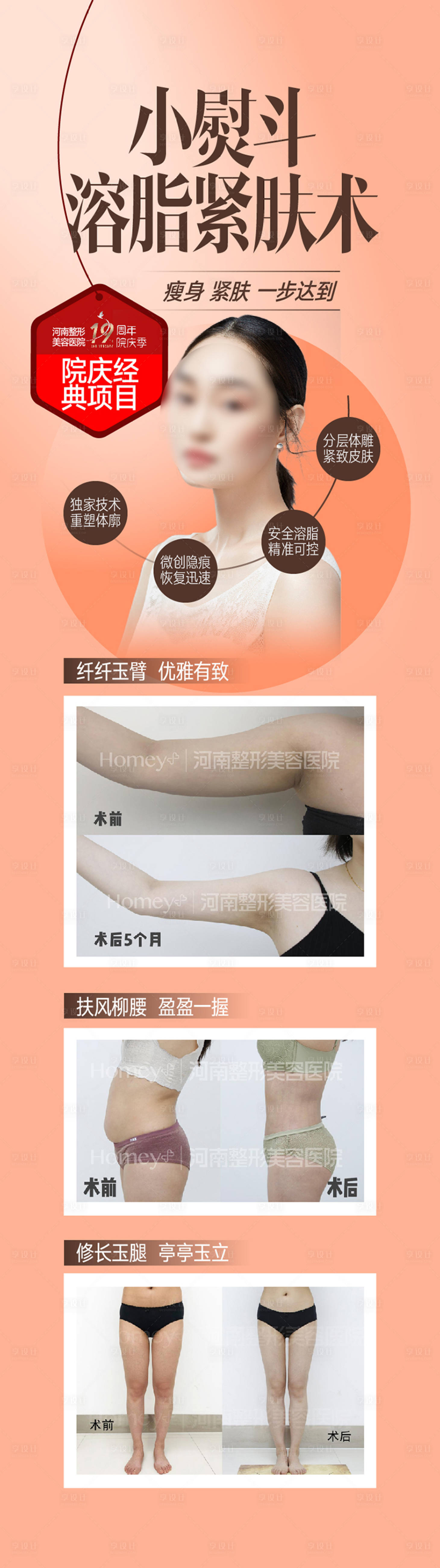 源文件下载【享设计】搜索编号：29370015899704244【医美溶脂紧肤术促销海报长图】