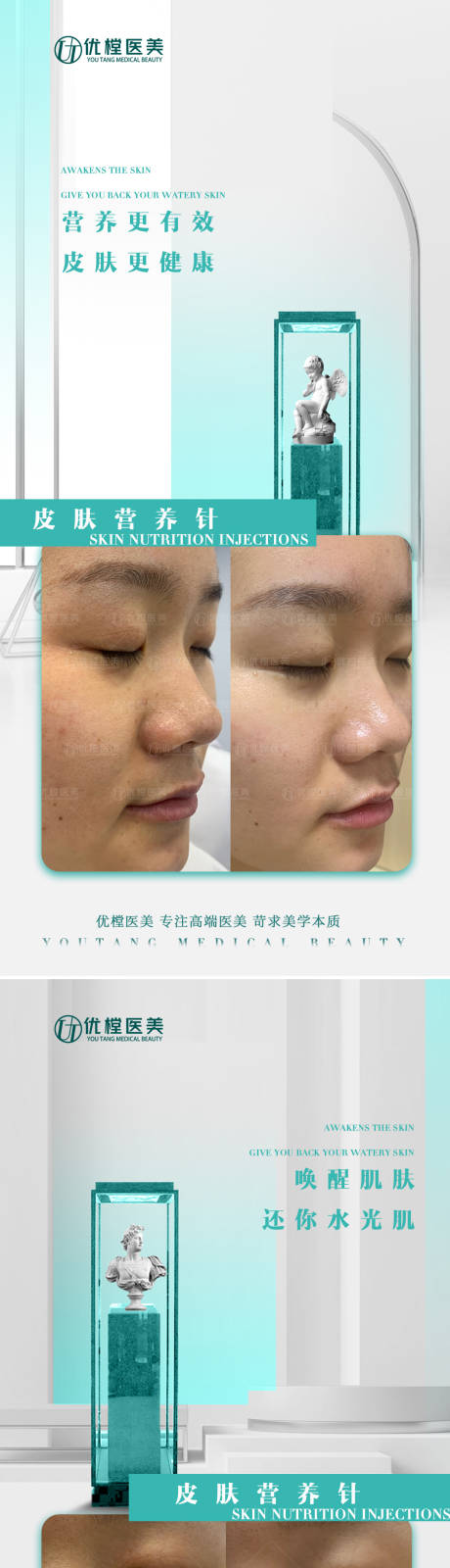 源文件下載【享設(shè)計】搜索編號：66730015881129676【醫(yī)美案例海報】