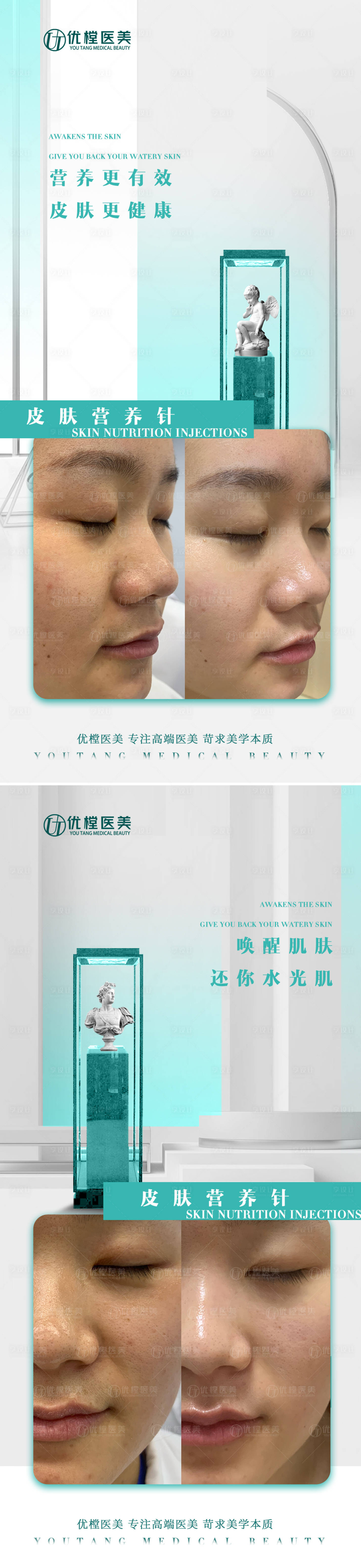 源文件下載【享設(shè)計】搜索編號：66730015881129676【醫(yī)美案例海報】