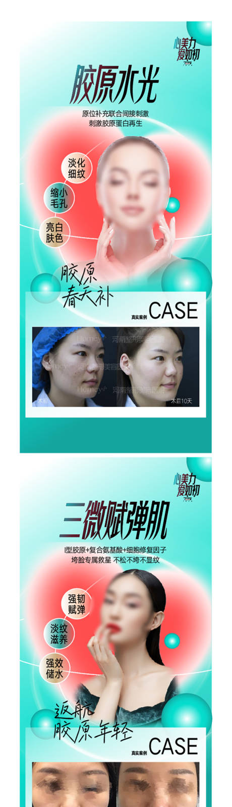 源文件下载【医美唤醒胶原海报】编号：66760015912051615