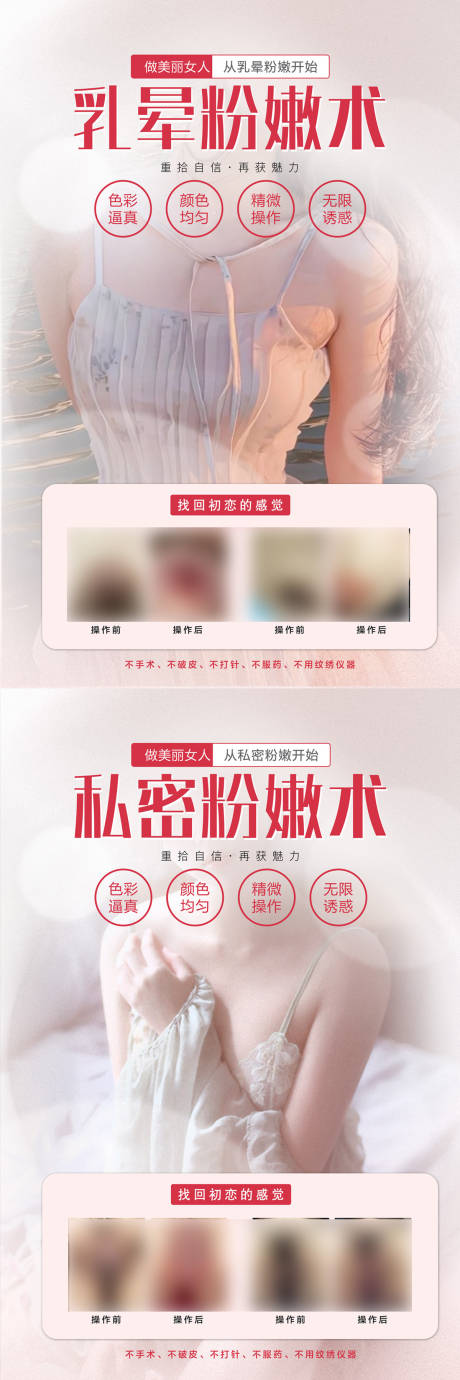 源文件下载【私密乳晕粉嫩术案例海报】编号：51420016649201329