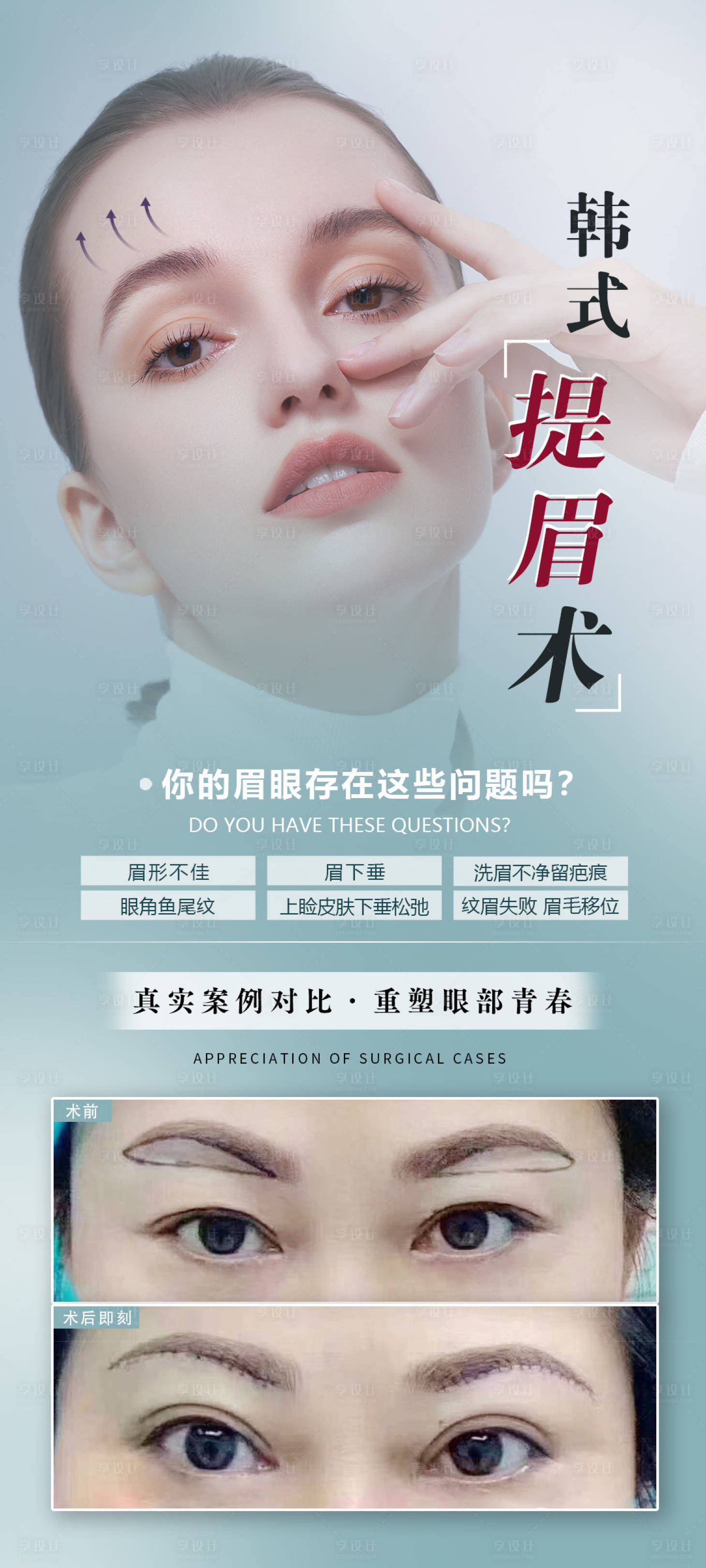 源文件下載【享設(shè)計】搜索編號：30770016773864035【提眉眼部醫(yī)美整形】