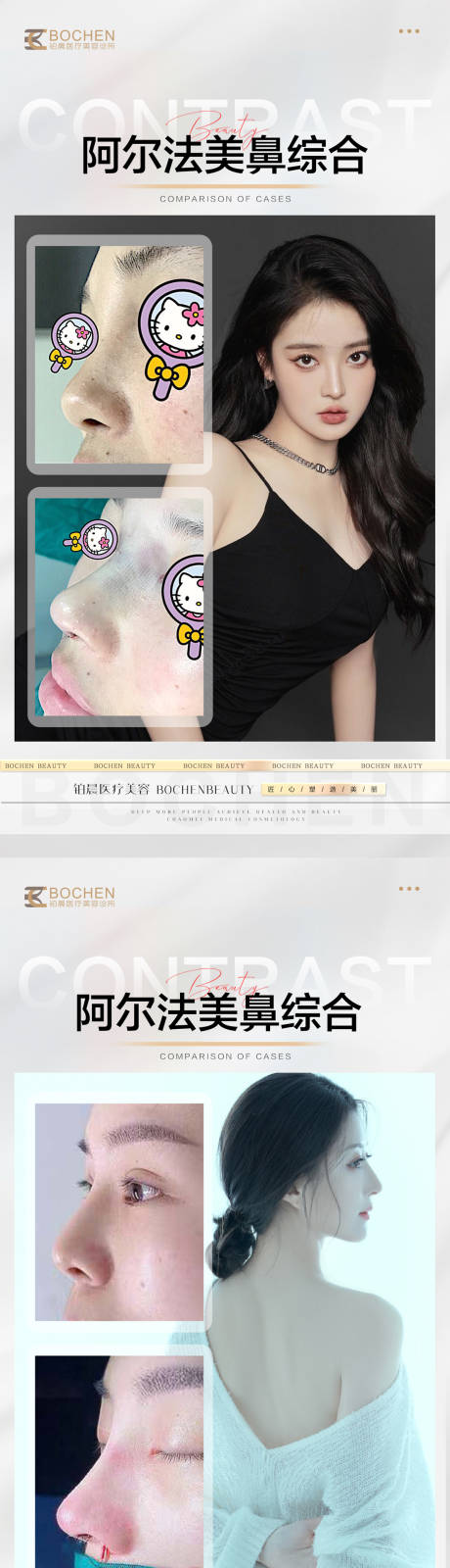 源文件下载【鼻综合案例海报】编号：88760016553935537