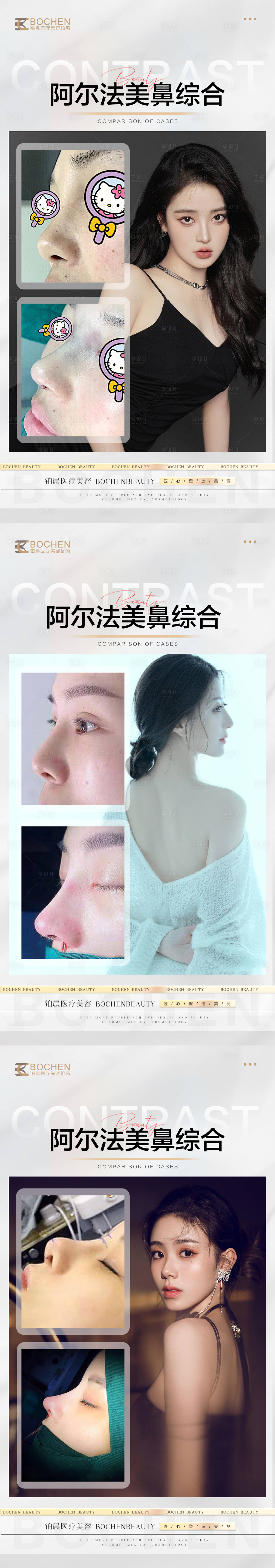 源文件下载【鼻综合案例海报】编号：88760016553935537