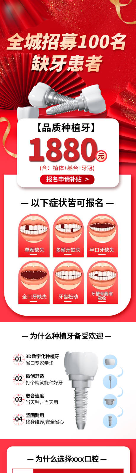 源文件下载【种植牙口腔种植首页】编号：70580016632421039