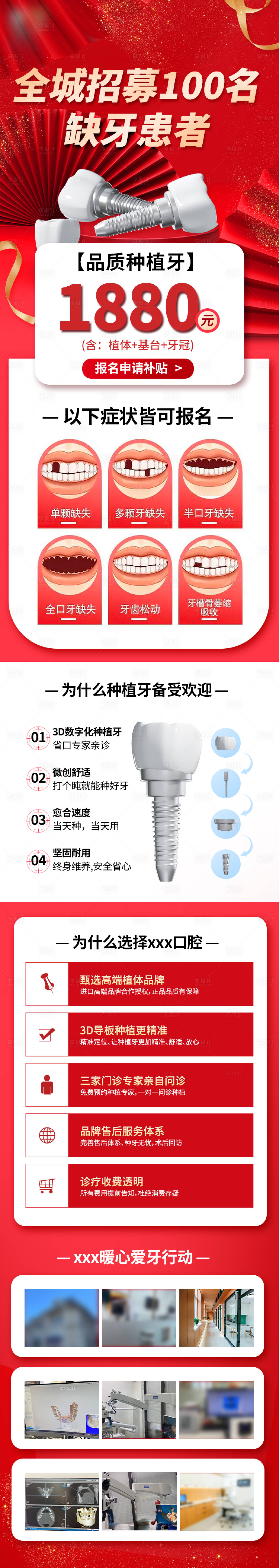 源文件下載【享設(shè)計(jì)】搜索編號(hào)：70580016632421039【種植牙口腔種植首頁(yè)】