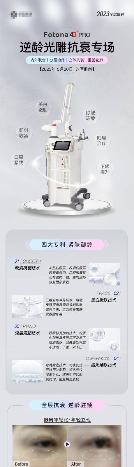 源文件下载【医美FOTONA 4DPro长图】编号：69380016803846570