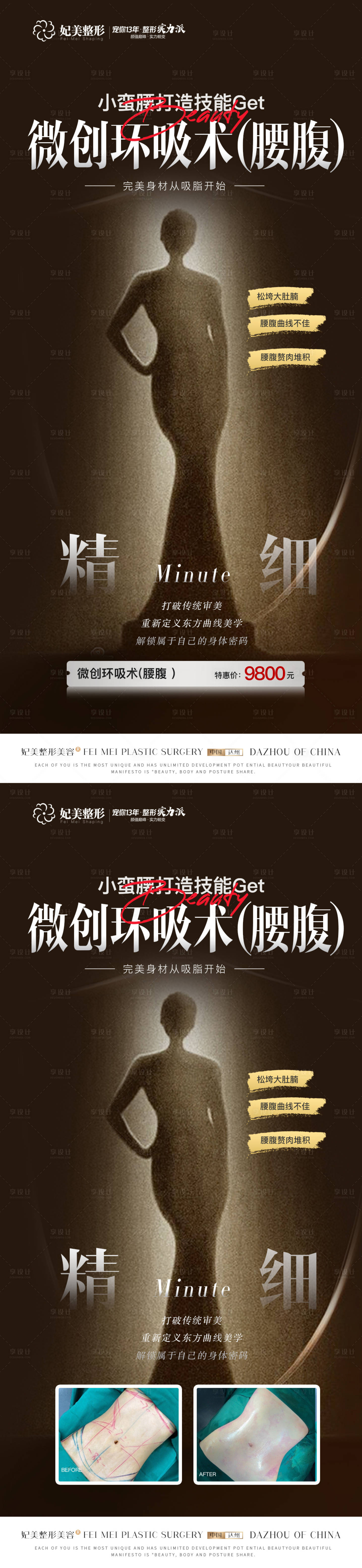 源文件下载【医美吸脂海报】编号：50820016648736830