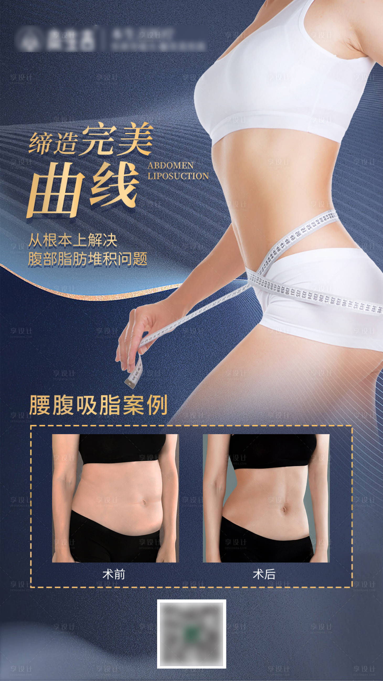源文件下载【腰腹吸脂案例对比海报】编号：35640017052094586