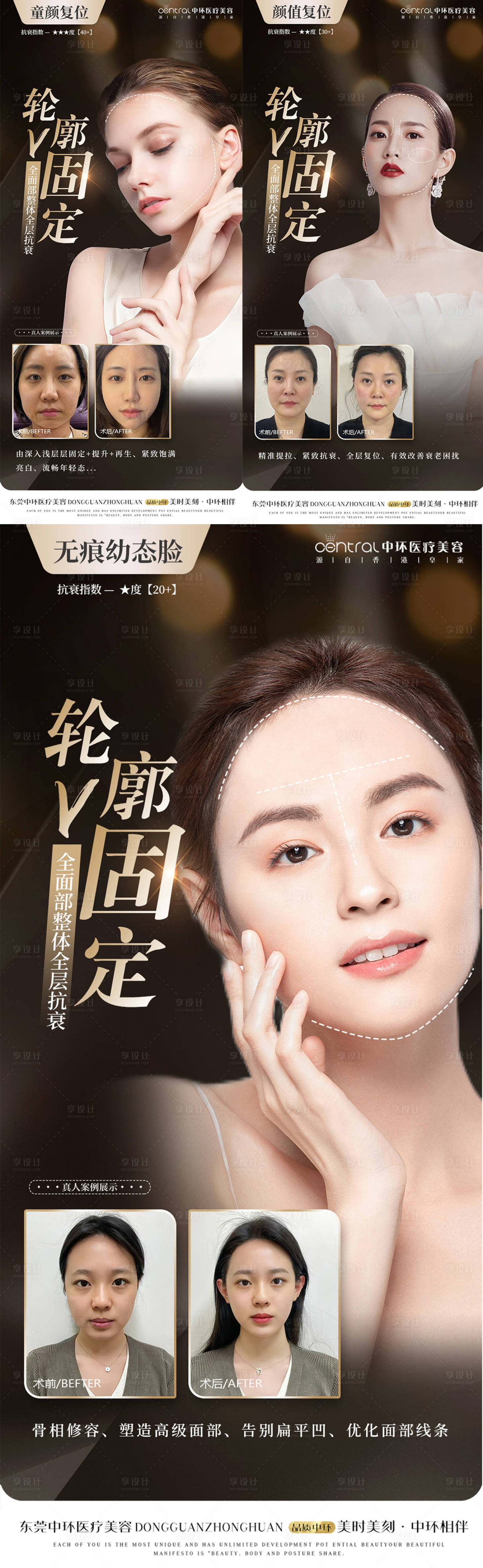 源文件下载【享设计】搜索编号：17710016684448568【轮廓固定案例对比系列】