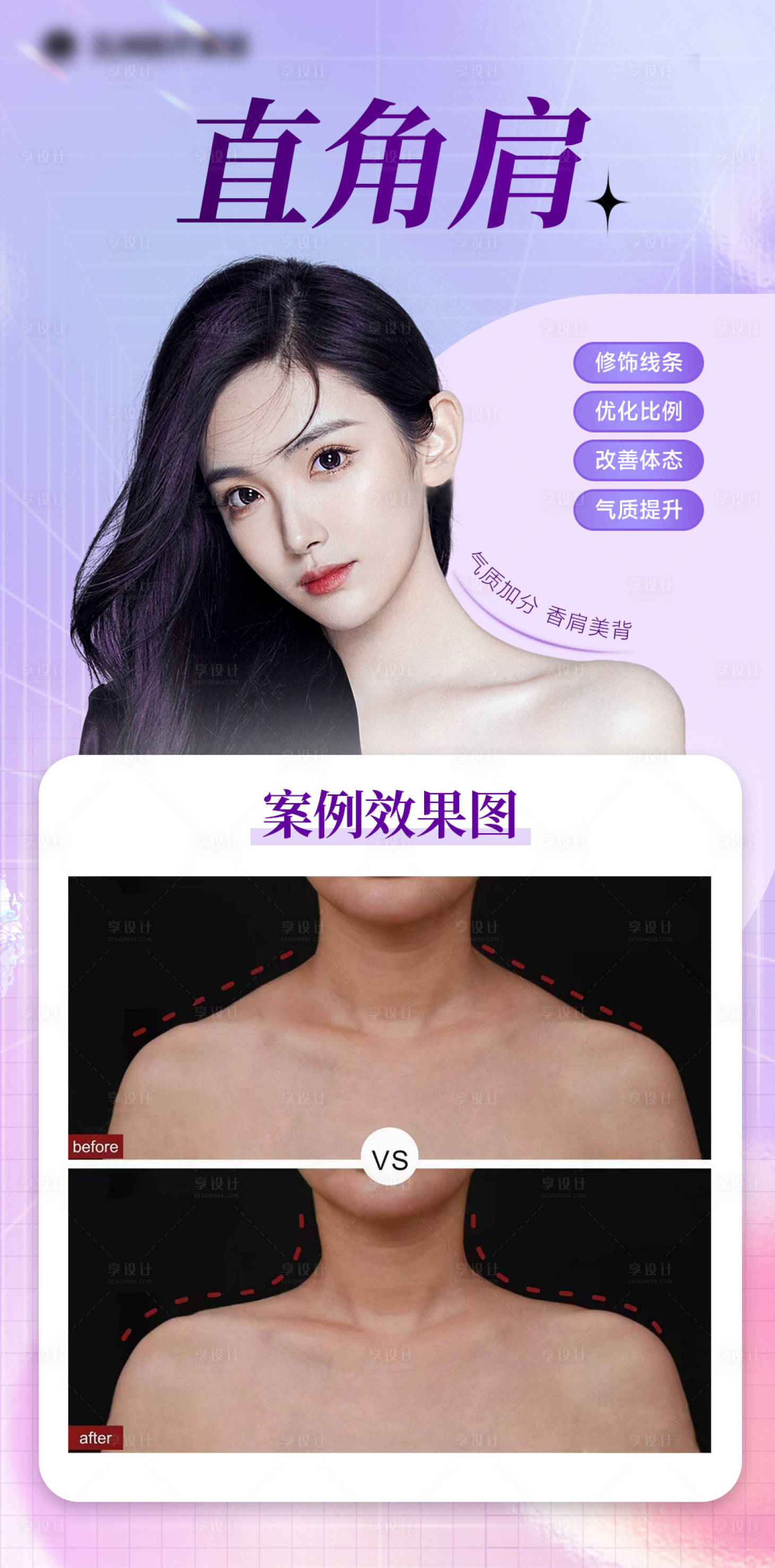 源文件下载【直角肩案例海报】编号：12950016778053876