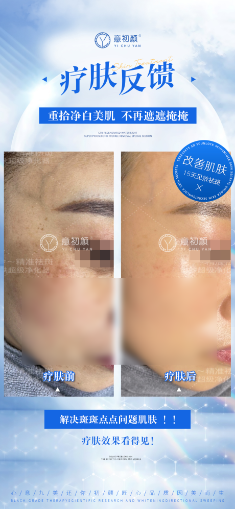 源文件下載【享設(shè)計(jì)】搜索編號(hào)：93570016509882158【醫(yī)美對(duì)比簡約海報(bào)】