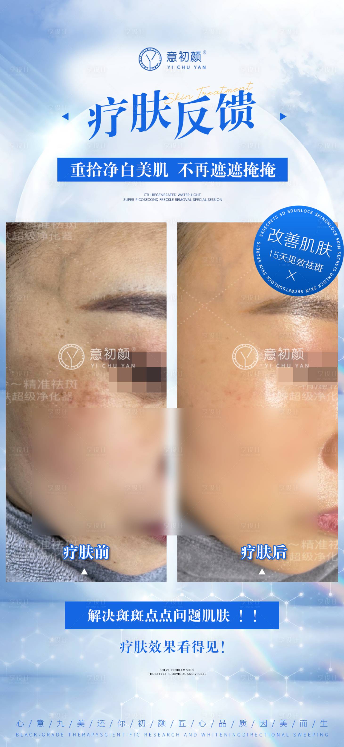 源文件下载【享设计】搜索编号：93570016509882158【医美对比简约海报】