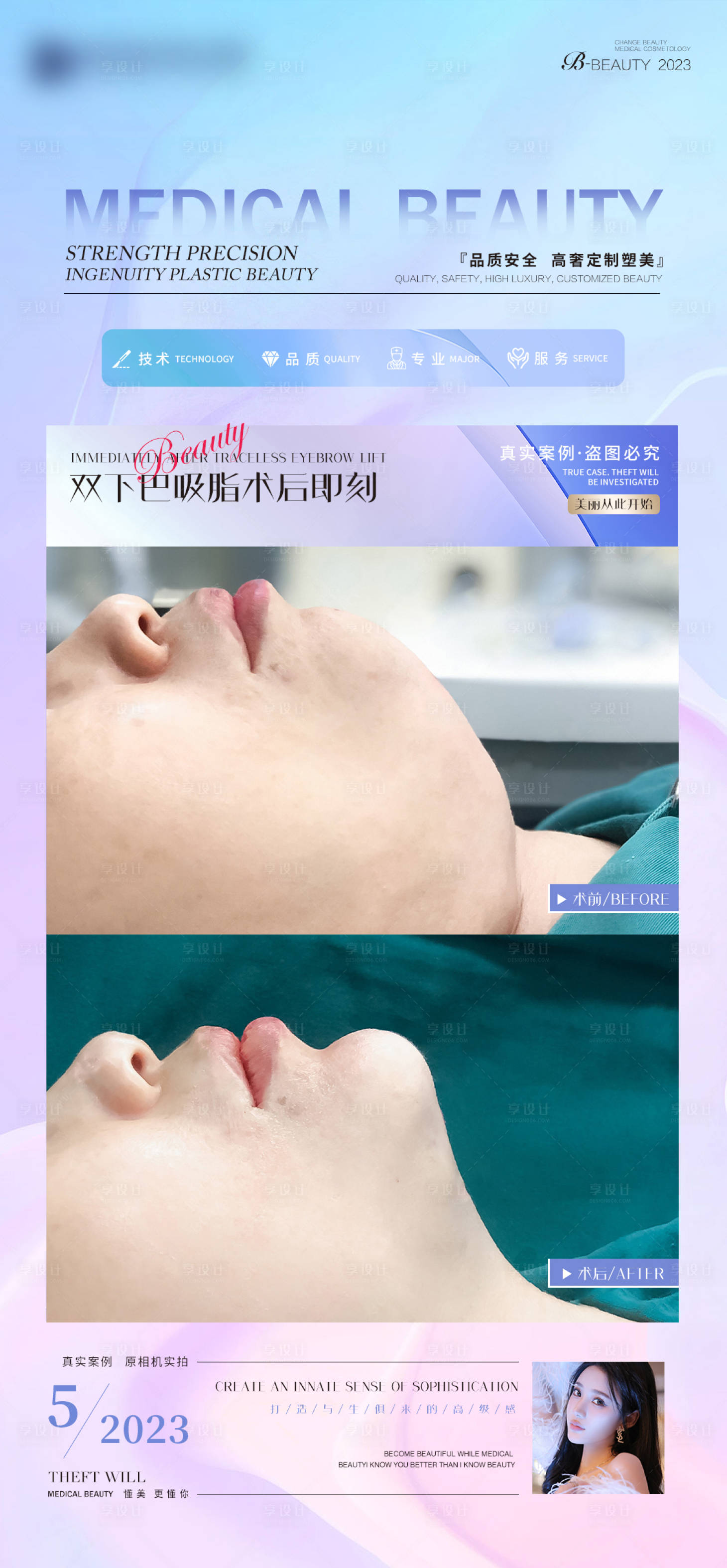 源文件下载【享设计】搜索编号：26610016425518204【案例对比海报】