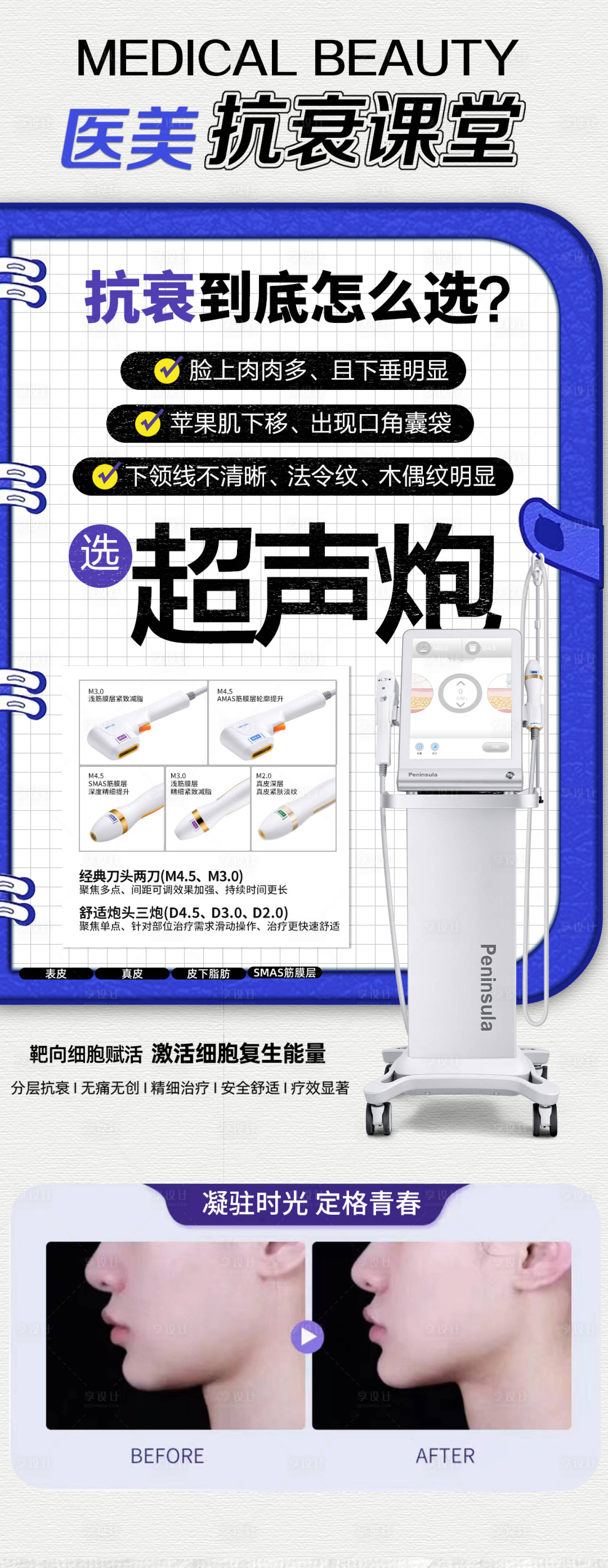 源文件下載【享設計】搜索編號：69530016503166821【超聲炮科普海報】