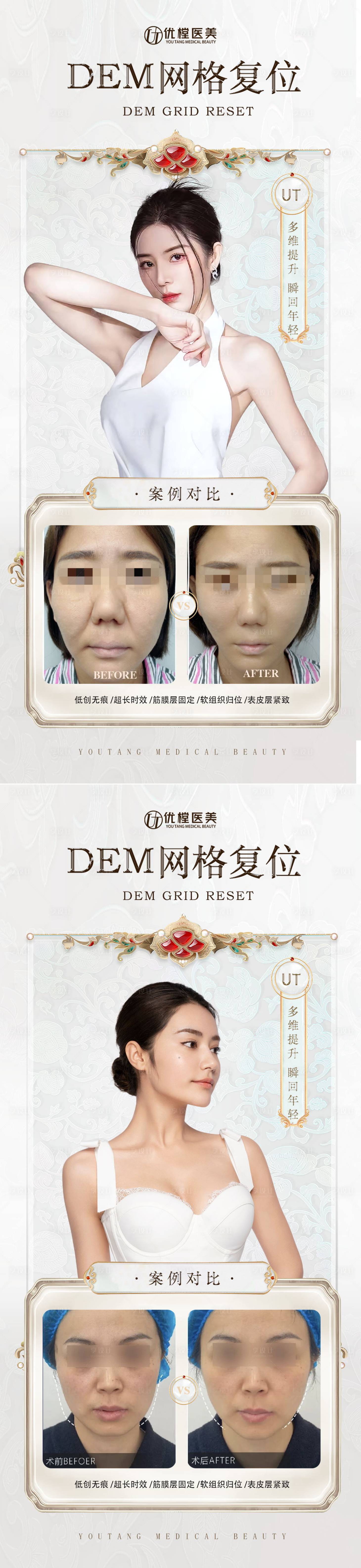 源文件下载【享设计】搜索编号：17220016645415726【医美轮廓固定案例】