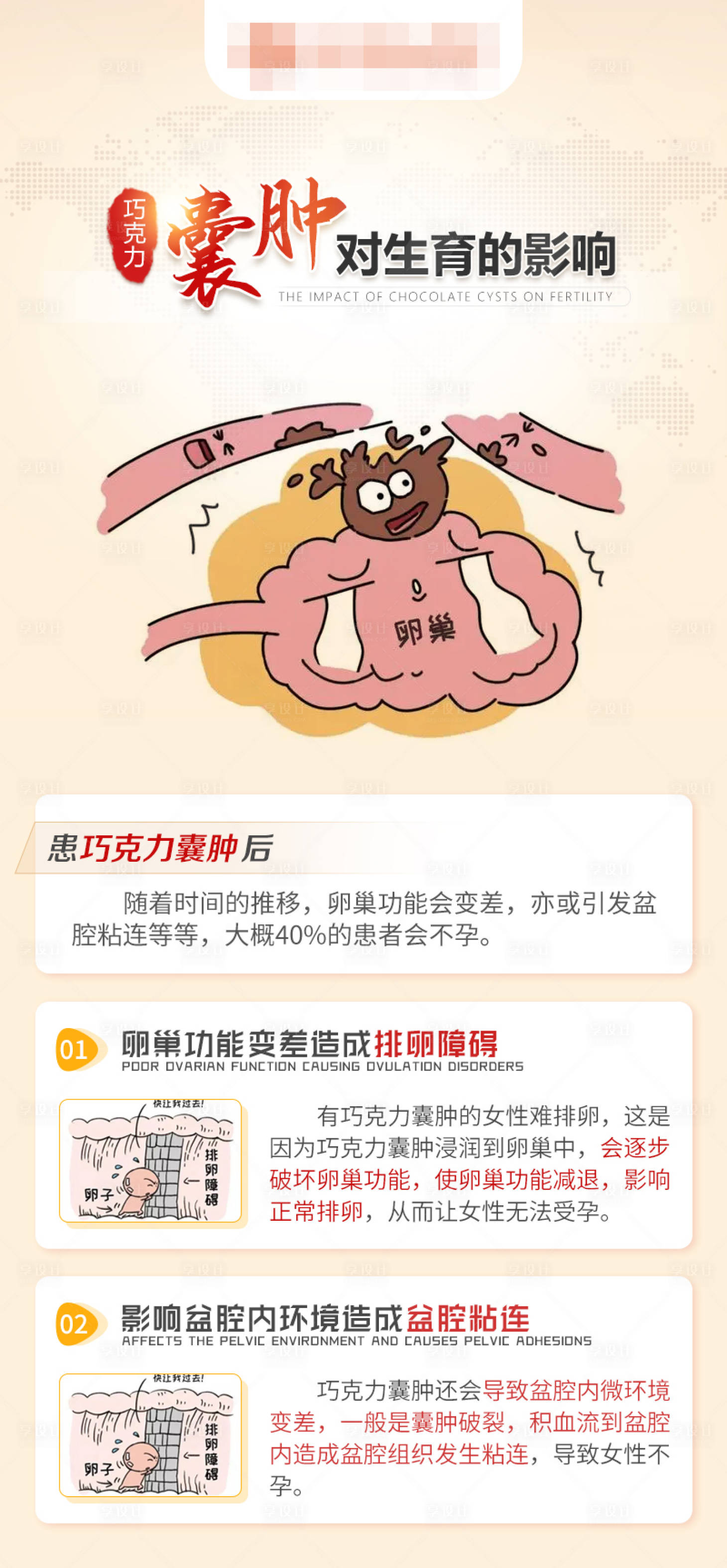 源文件下载【巧克力囊肿对生育的影响】编号：13980016703896856
