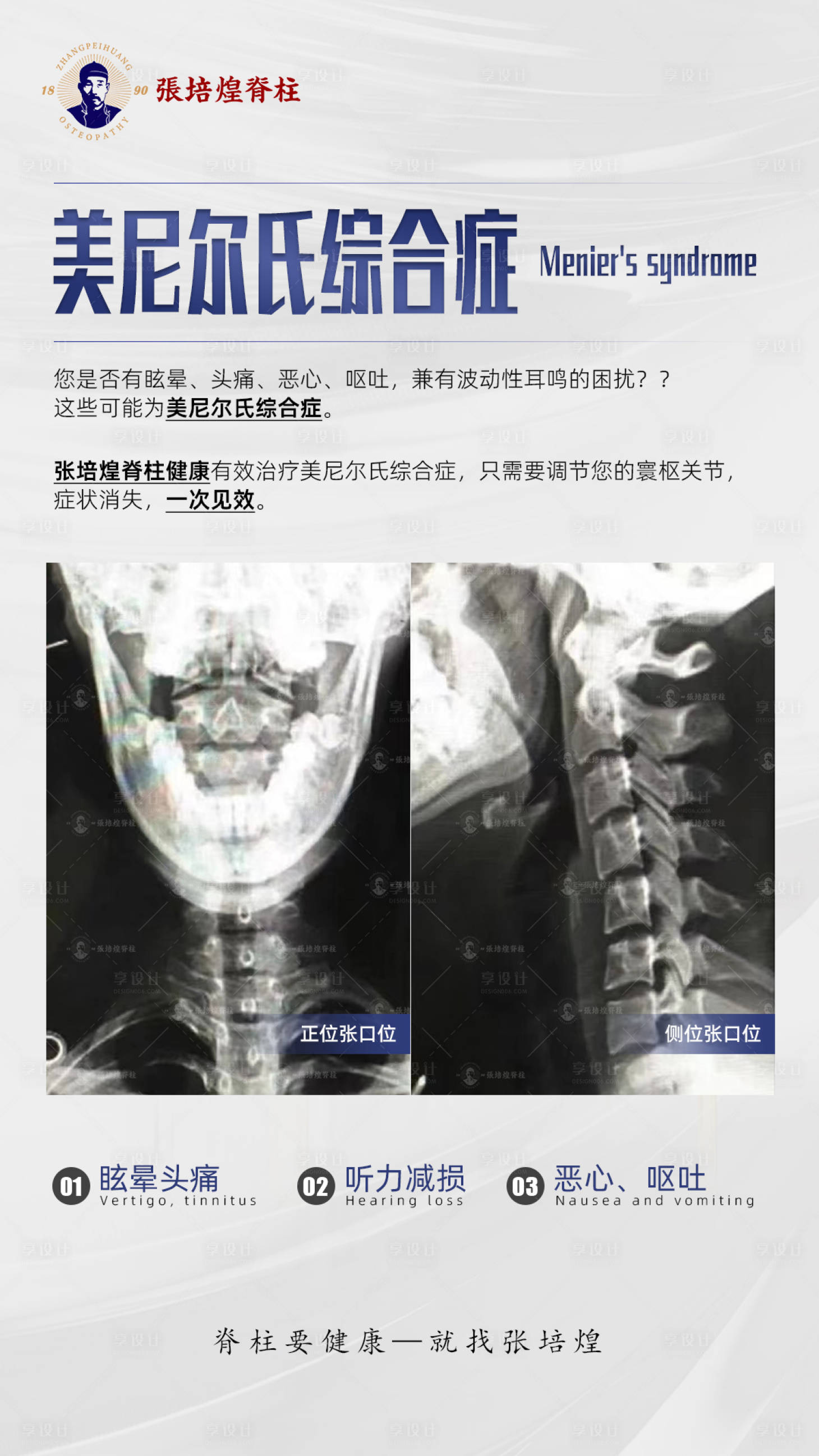 源文件下載【享設(shè)計(jì)】搜索編號：31550016797503080【脊柱案例海報(bào)】
