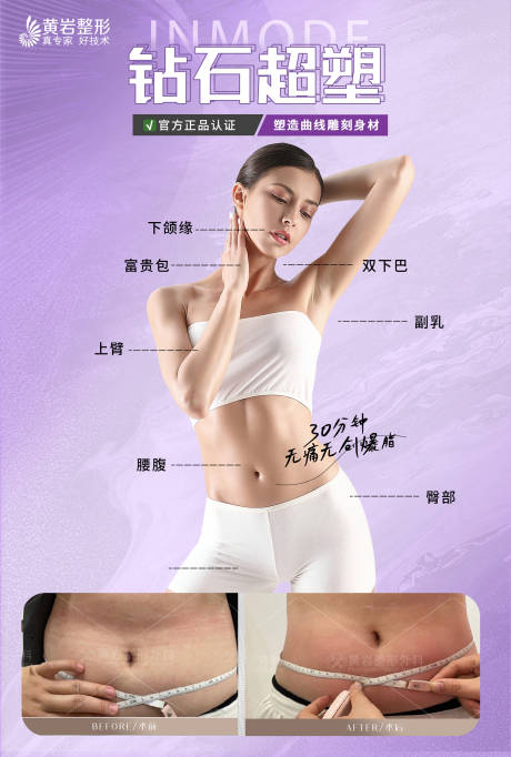 源文件下载【Inmode钻石超塑】编号：90700016823516923