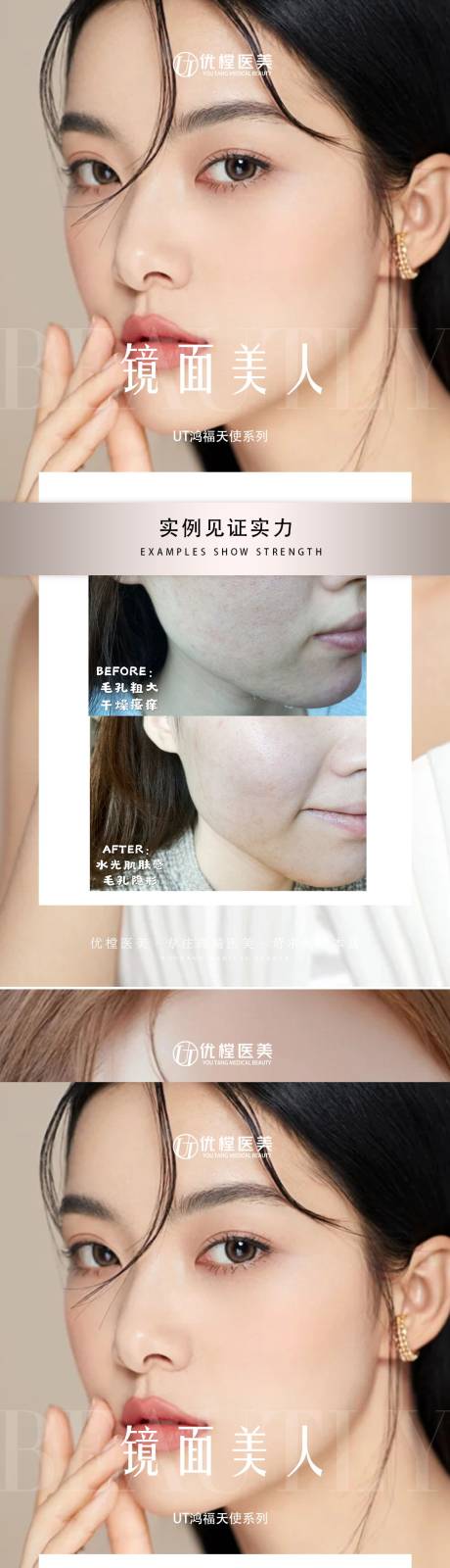 源文件下載【醫美案例對比系列海報】編號：30410016761585108