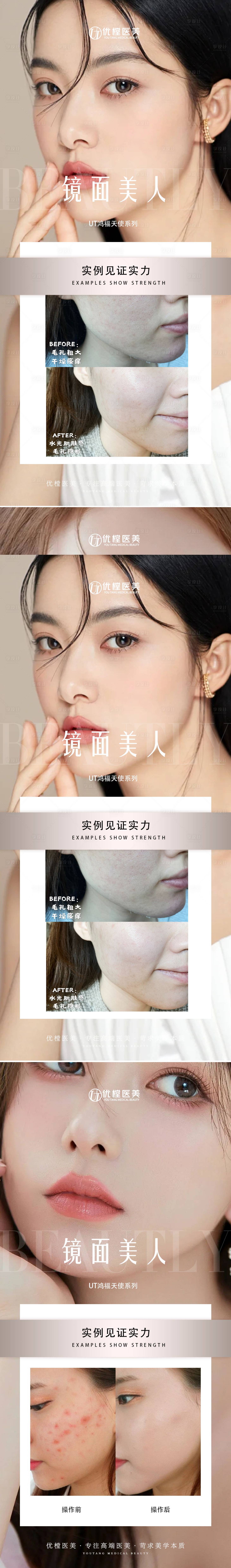 源文件下載【醫(yī)美案例對比系列海報】編號：30410016761585108