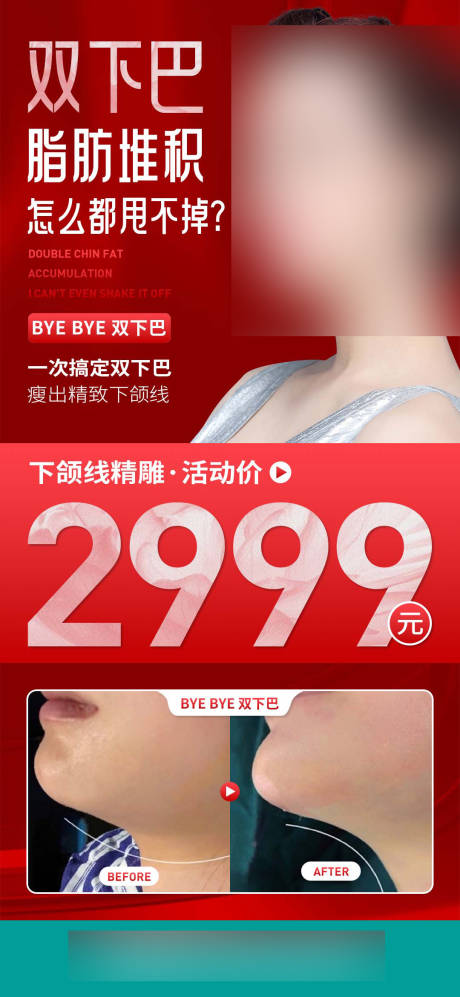 源文件下载【医美双下巴项目海报】编号：20990016680662628